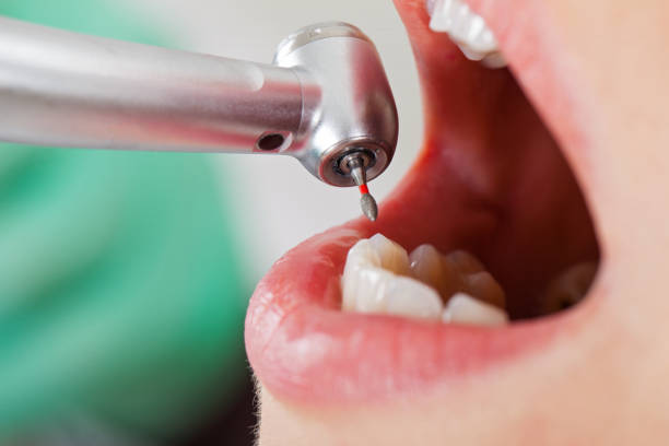 Best Pediatric Emergency Dentist in Sylvester, GA